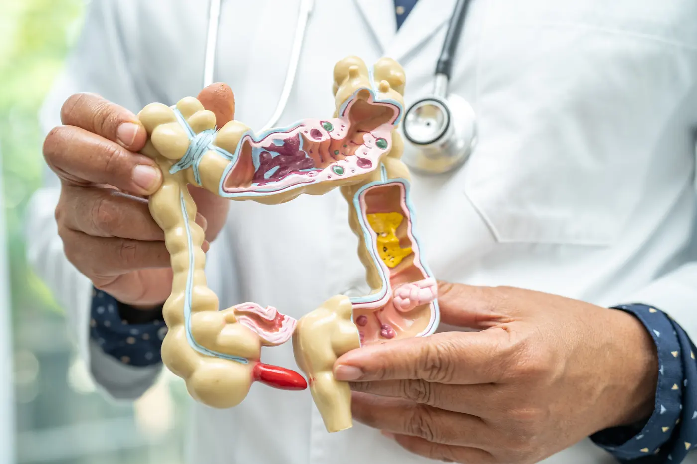 Procedimiento — Apendicectomía laparoscópica por apendicitis en Zapopan en Hospital Ángeles Andares